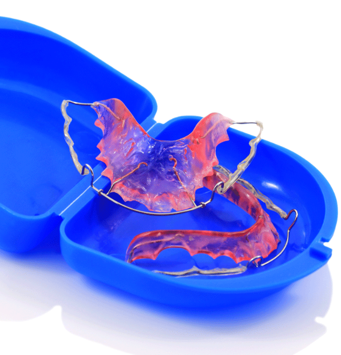 Dental Retainers